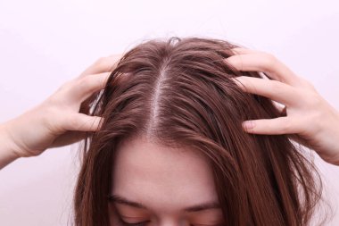 Close up of woman with dirty and greasy hair. Oily hair problem clipart