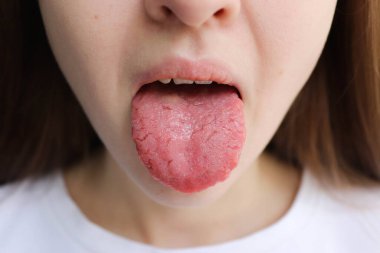 Dil sorunları. Coğrafi dili olan kadın. Göçmen parlaklığı