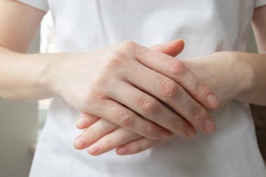 Bir kadının ellerinde kurumuş, çatlamış deri parçaları. Cilt susuzluğu, kronik kuru cilt.