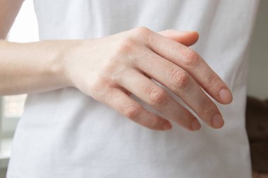 Pul pul olmuş, derisi kurumuş bir kadın eli. Kurumuş, rahatsız ve kaşıntılı..