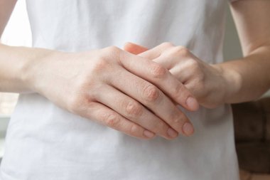 Ellerinde çatlamış, soyulmuş ve kuru deri var. El rahatsızlığı, kaşıntı, yanma hissi, alerji..