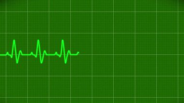 Gerçekçi bir kalp atış hızı animasyonu, arka planda keskin tepeler ve vadilerle sürekli bir kalp atışı çizgisi sergiliyor. Parlak yeşil çizgi ritmik olarak titreşiyor, dinamik ve görsel olarak çarpıcı tıbbi temalı bir görüntü yaratıyor..