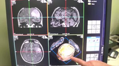 Beyin 3D MRI Film Videosunu Görüntüle