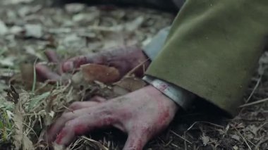 İki yaralı el birbirine kenetlendi, ellerinizi yakın tutun.