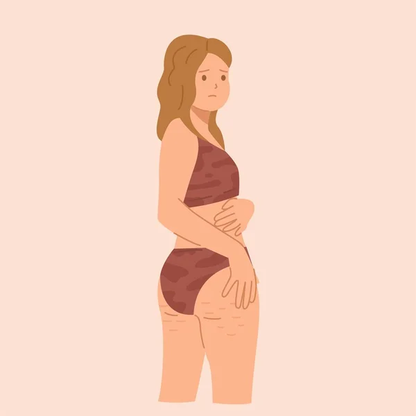 Mujer Joven Ropa Interior Está Molesta Debido Celulitis Sus Nalgas — Archivo Imágenes Vectoriales
