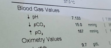 close-up of blood gas analysis report with ph pco2 po2 values and abnormal results, ideal for medical education, respiratory care, critical care, and clinical training visuals