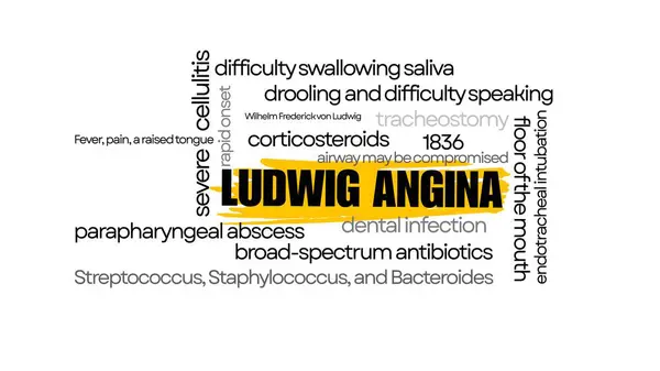 Ludwig Angina hakkında eğitici sözcük bulutu semptomlar, anatomi, patojenler ve tedavi terimleri içeriyor. Klinik farkındalık ve tıp eğitimi için ideal.