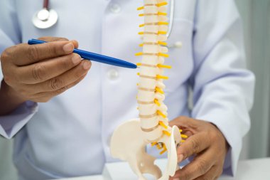 Omurga ve kemik modeli taşıyan Asyalı doktor, ortopedi bölümünde tedavi için bel kemiği yerinden oynamış disk parçası..