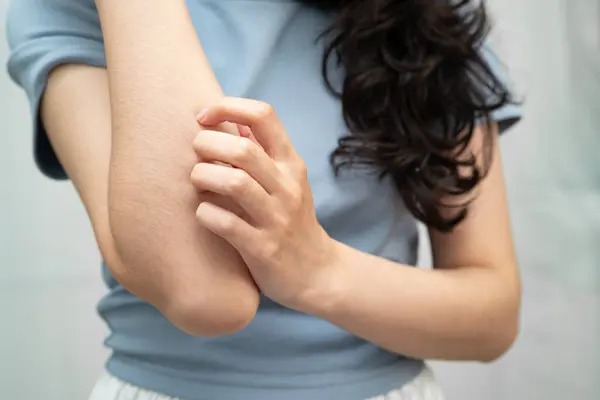 El kaşıma kullanarak cilt hastalıklarından kaşınan Asyalı kadın.