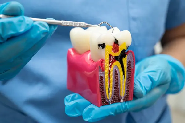Diş implantı tutan diş hekimi, çeneye yapay diş kökleri, diş tedavisi kanal tedavisi, diş eti hastalığı, dişçi için diş modeli.