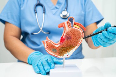 Mide hastalığı, hastanede teşhis ve tedavi için anatomi modeli tutan bir doktor..