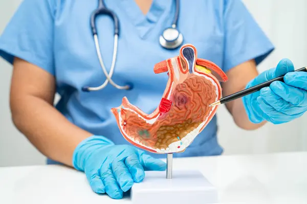 Mide hastalığı, hastanede teşhis ve tedavi için anatomi modeli tutan bir doktor..