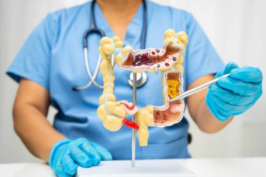 Bağırsak, Asyalı kadın insan anatomisi modeli tutuyor..