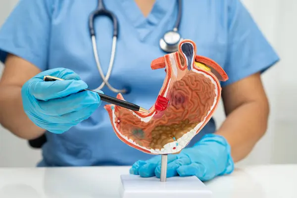 Mide hastalığı, Asyalı bir kadın hastanede teşhis ve tedavi için anatomi modeli tutuyor..