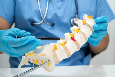 Omurga ve kemik modeli taşıyan Asyalı doktor, ortopedi bölümünde tedavi için bel kemiği yerinden oynamış disk parçası..