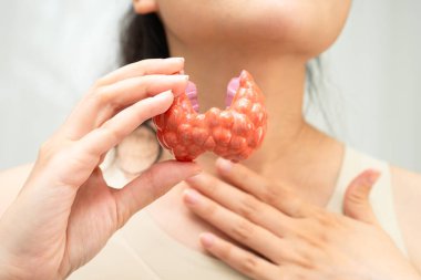 Hipertiroidizm, aşırı aktif tiroid, tiroid lenfoma, tiroid bezi insan anatomisi olan Asyalı kadın..