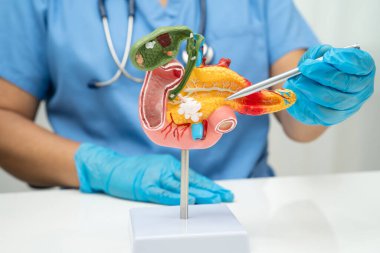 Pankreas iltihabı, pankreas hastası Asyalı doktor, safra kesesi ve safra kesesi insan anatomisi modeli..