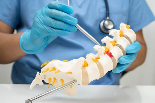 Omurga ve kemik modeli taşıyan Asyalı doktor, ortopedi bölümünde tedavi için bel kemiği yerinden oynamış disk parçası..