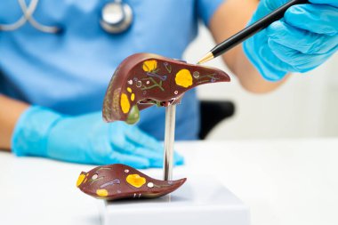 Dünya Hepatit Günü 'nde siroz, karaciğer kanseri, yağlı karaciğer, karaciğer anatomisi olan Asyalı doktor..