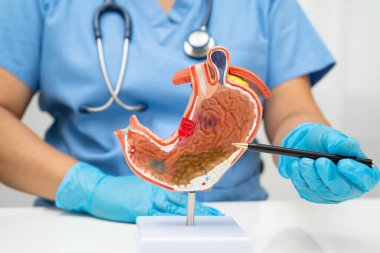 Mide hastalığı, hastanede teşhis ve tedavi için anatomi modeli tutan bir doktor..