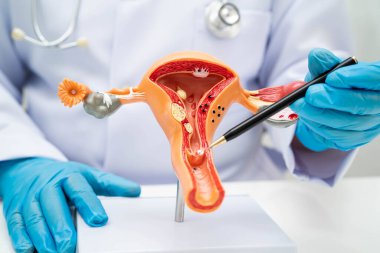 Rahim, hastanede teşhis ve tedavi için insan anatomisi modeli tutan doktor..