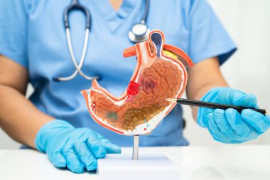Mide hastalığı, hastanede teşhis ve tedavi için anatomi modeli tutan bir doktor..