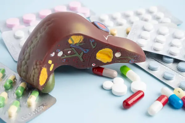 Hap tedavisi gören karaciğer modeli, siroz, karaciğer kanseri, yağlı karaciğer..