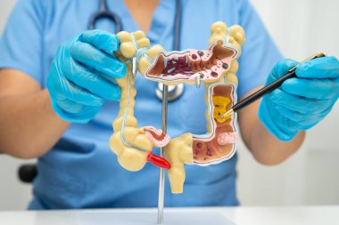 Bağırsak, Asyalı kadın insan anatomisi modeli tutuyor..