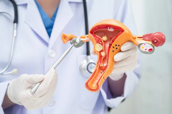 Rahim, hastanede teşhis ve tedavi için insan anatomisi modeli tutan doktor..
