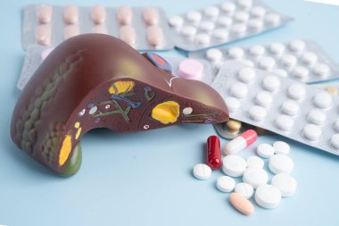 Hap tedavisi gören karaciğer modeli, siroz, karaciğer kanseri, yağlı karaciğer..