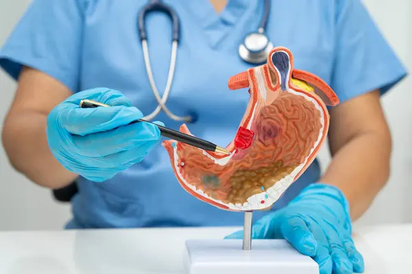 Mide hastalığı, hastanede teşhis ve tedavi için anatomi modeli tutan bir doktor..