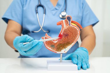 Mide hastalığı, hastanede teşhis ve tedavi için anatomi modeli tutan bir doktor..