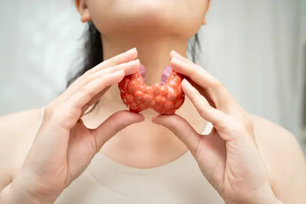 Hipertiroidizm, aşırı aktif tiroid, tiroid lenfoma, tiroid bezi insan anatomisi olan Asyalı kadın..