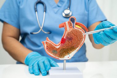 Mide hastalığı, hastanede teşhis ve tedavi için anatomi modeli tutan bir doktor..