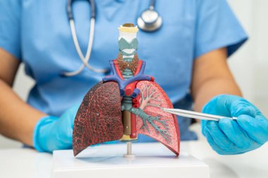 Siroz, karaciğer kanseri, yağlı karaciğer, karaciğer anatomisi olan Asyalı kadın..