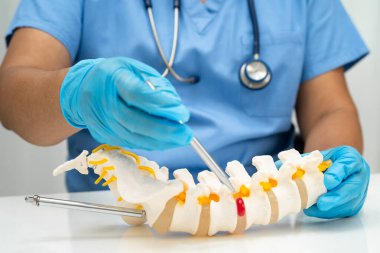 Omurga ve kemik modeli taşıyan Asyalı doktor, ortopedi bölümünde tedavi için bel kemiği yerinden oynamış disk parçası..