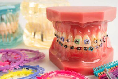 Ortodontik bağlar halkalar ve kravatlar, diş hekimliği üzerine çalışan dişçi için model..