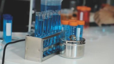 kan örnekleri ile test tüpleri