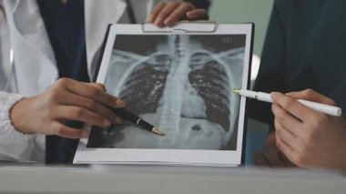 Doktor X-ışınlarını tutuyor.