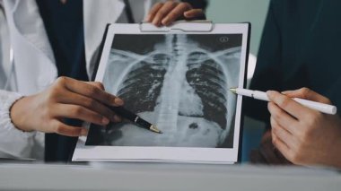 Doktor, hastanın röntgenini klinikte tutuyor.