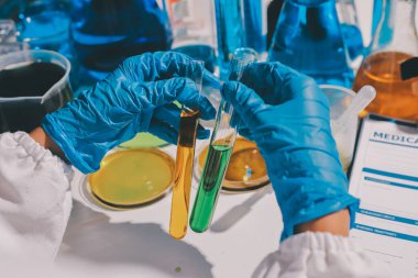 Bilimadamı laboratuarda tıbbi örnekleri mikro plakaya yerleştiriyor.