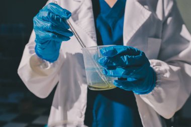 Bilimadamı laboratuarda tıbbi örnekleri mikro plakaya yerleştiriyor.