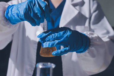 Bilimadamı laboratuarda tıbbi örnekleri mikro plakaya yerleştiriyor.