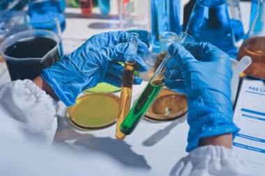 Bilimadamı laboratuarda tıbbi örnekleri mikro plakaya yerleştiriyor.