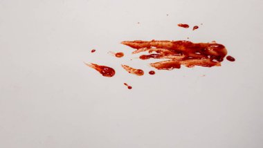 Yakın plan çekimde kan sıçrıyor ve beyaz arka plana sıçrıyor. Düzenleme, kırmızı damlacıklar ve çizgilerden oluşan görsel bir model yaratıyor. Görüntü, kanın dokusunu ve rengini belirginleştiriyor.