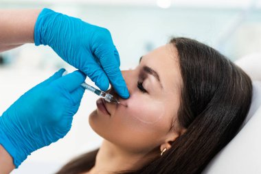 Güzellik uzmanı, kadının elmacık kemiklerine hyaluronik asit doldurucu yerleştiriyor. Hyaluronik asit doldurucu iğneyle ya da kanülle enjekte edilir. Yüz hatları konsepti.