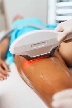 Beautiful young woman receiving professional laser hair removal treatment. Modern beauty epilation. Close up shot.