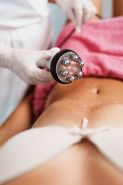 Cavitation RF vücut tedavisi ve sağlık güzelliğinin iyileştirilmesi ve yağ ve selülit alınması için çağdaş ilaç