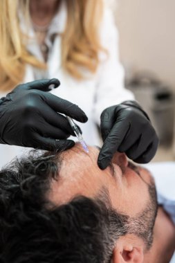 Yakışıklı orta yaşlı sakallı adam güzellik kliniğinde gençleştirici yüz enjeksiyonu yaptırıyor. Güzellik uzmanı erkek kırışıklıklarını botulinyum toksin iğneleriyle ya da hyaluronik asit doldurucularıyla dolduruyor..