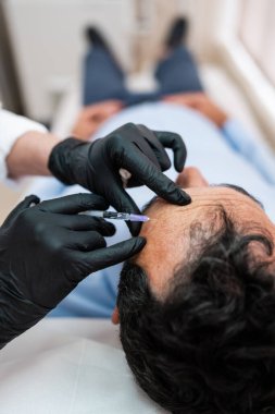 Yakışıklı orta yaşlı sakallı adam güzellik kliniğinde gençleştirici yüz enjeksiyonu yaptırıyor. Güzellik uzmanı erkek kırışıklıklarını botulinyum toksin iğneleriyle ya da hyaluronik asit doldurucularıyla dolduruyor..